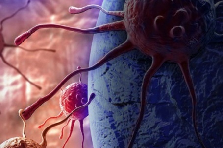 Tế bào ung thư 'thích' gì nhất? Cảnh báo 1 môi trường thuận lợi cho...