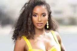 Người đẹp Jamaica sau tai nạn ở Hoa hậu Hoàn vũ