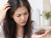 8 nguyên nhân tiềm ẩn gây rụng tóc, hói đầu và cách khắc phục