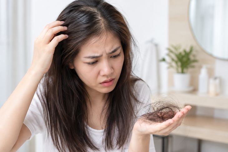Có nhiều nguyên nhân gây rụng tóc và mỗi nguyên nhân cần xử trí khác nhau. Ảnh minh họa AI.