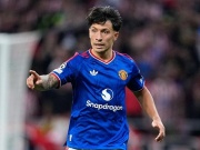 Lý do MU không thể "trảm" Lisandro Martinez sau phát ngôn gây sốc