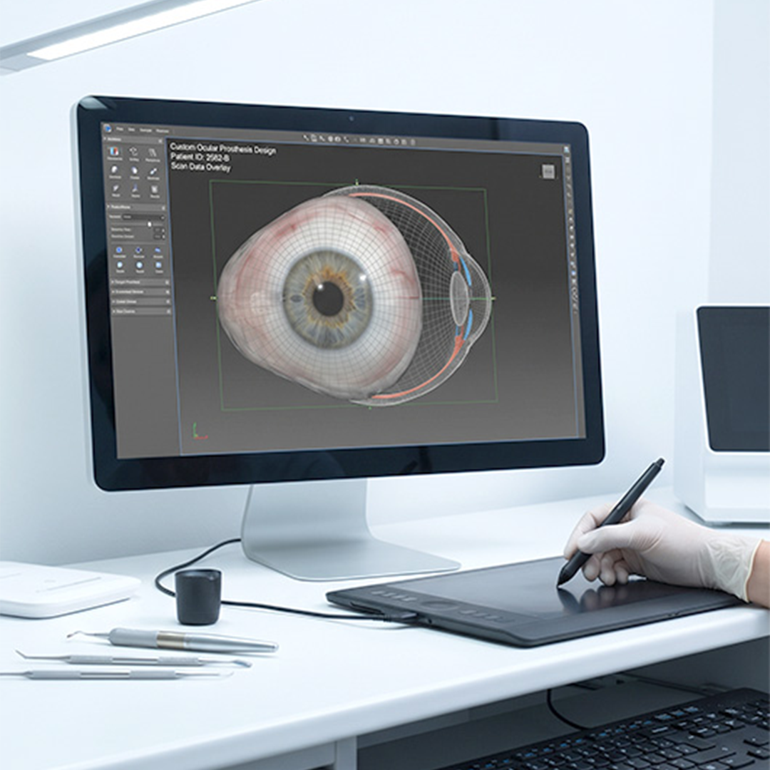 Mắt cá nhân 3D: Để người khiếm khuyết mắt tìm lại trọn vẹn sự tự tin - 2
