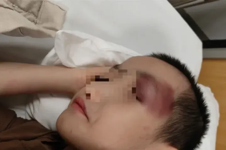 Thông tin mới vụ bé trai 6 tuổi bị chấn thương sọ não khi gửi tại cơ sở can thiệp