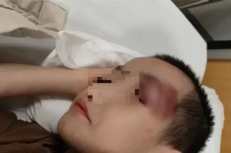 Thông tin mới vụ bé trai 6 tuổi bị chấn thương sọ não khi gửi tại cơ sở can thiệp