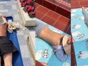 Sau 'chanh liều cao' lại xuất hiện hội 'thích phơi nắng': Cẩn thận ung thư da